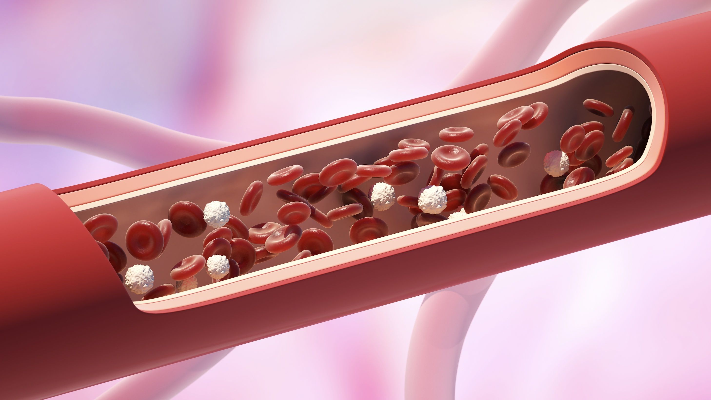 정상 콜레스테롤 수치란?