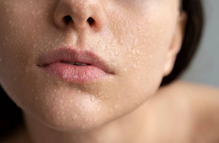 얼굴피지 제거방법