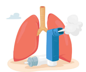 폐렴 증상, 전염성, 치료기간 총정리 (2025ver)