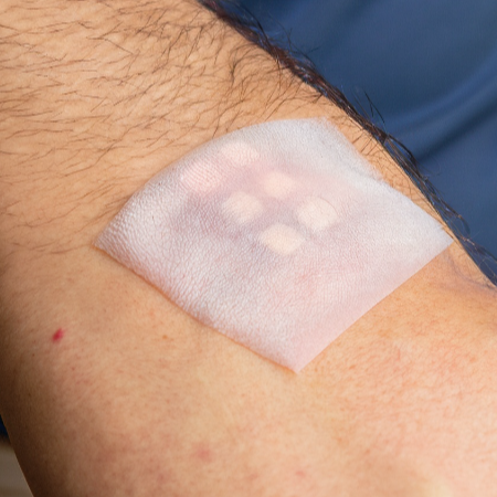 화상물집-치료방법