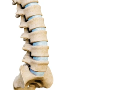 허리디스크 증상