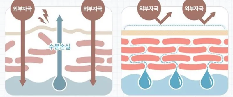 피부 장벽