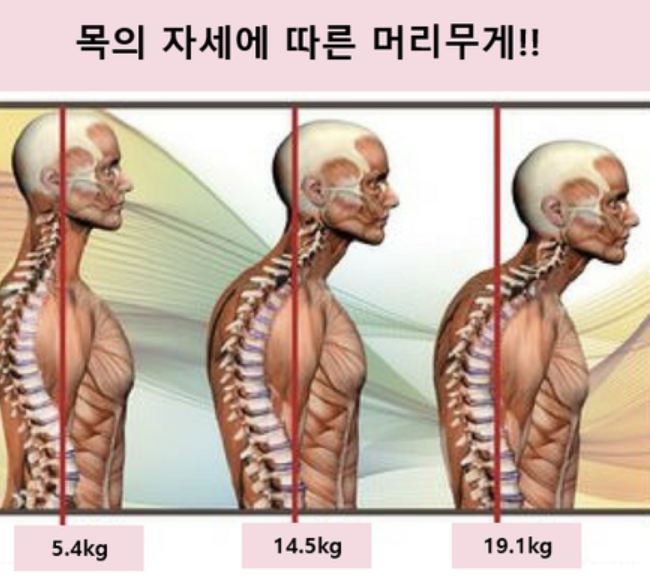 목디스크 7
