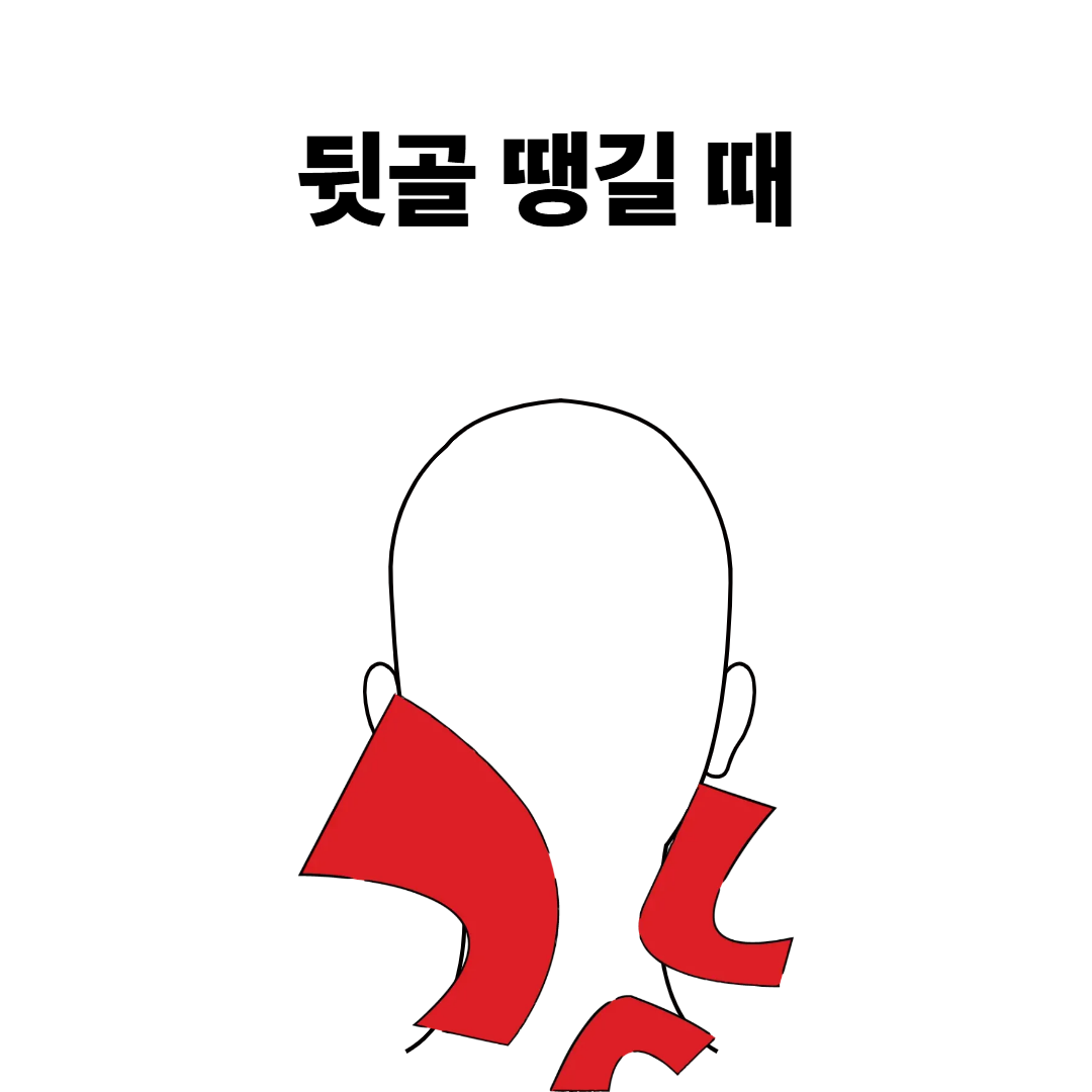 뒷골