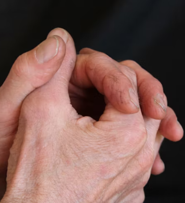 콘드로이친 효능 복용법 시간 부작용