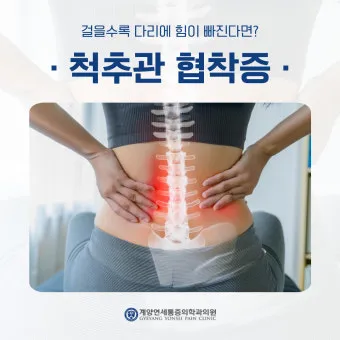 다리에 힘이 없는 증상 4가지 이유와 해결방안_5