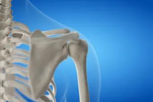 회전근개파열-수술비용