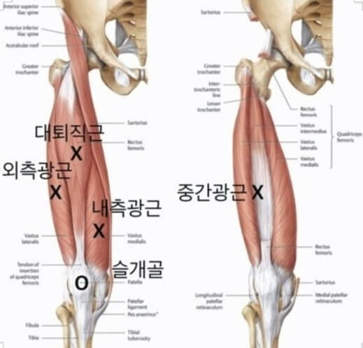 슬개대퇴통증