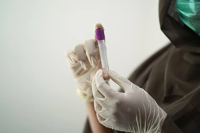 급성 인두염 검사와 진단 설명