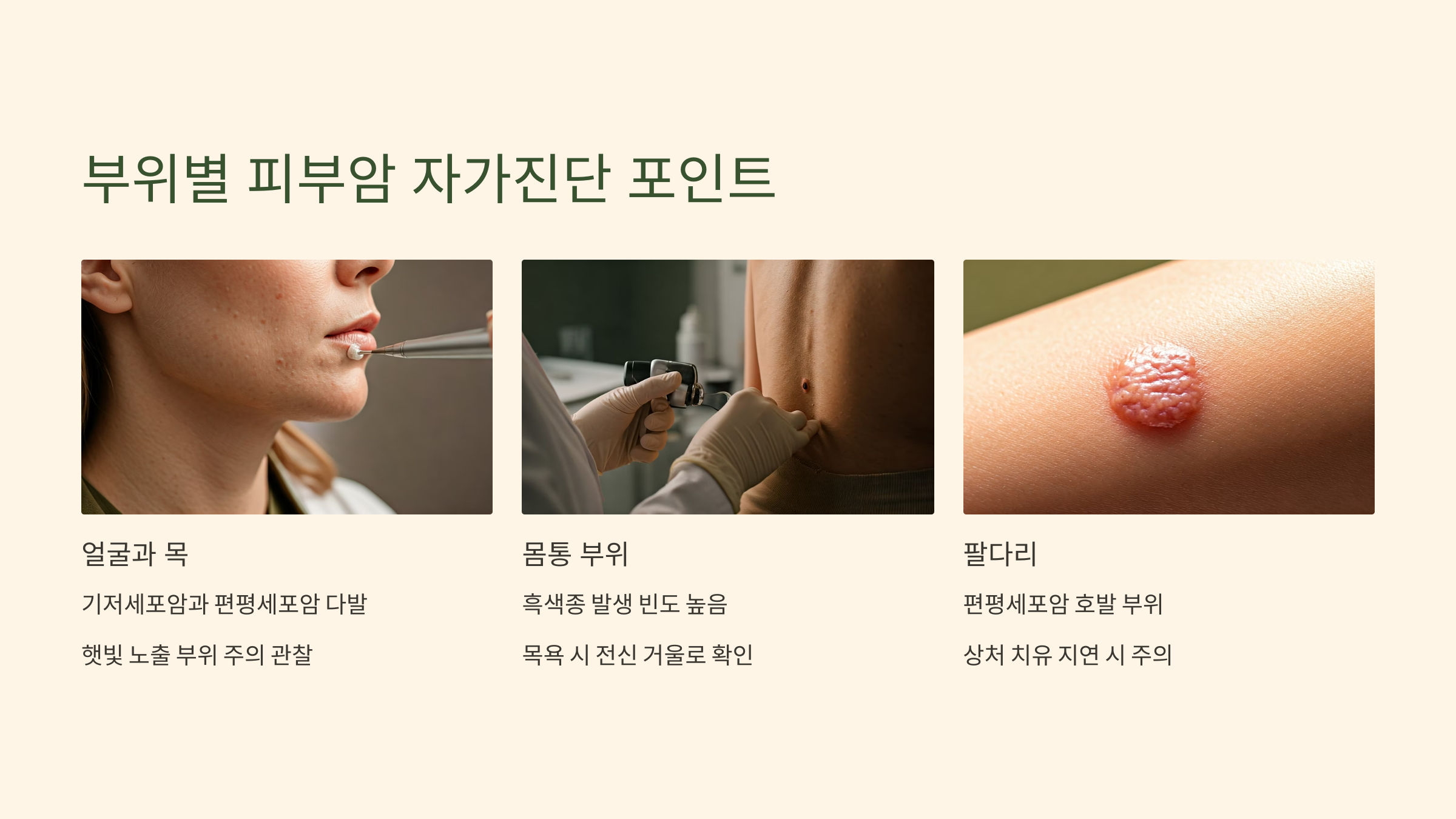 피부암 부위별 자가진단 포인트