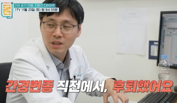 간경변증