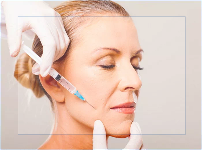 입가 주름보톡스