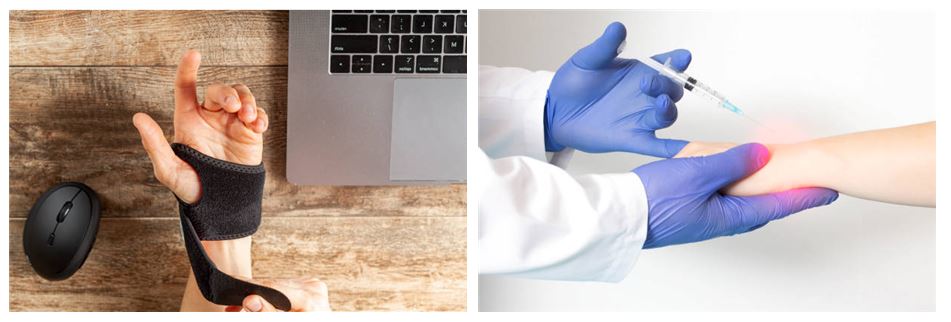 손목터널증후군