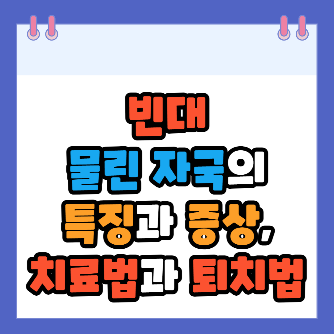 빈대
