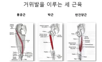 거위발 건염 원인과 증상 무릎 안쪽 통증 치료법 정리_3