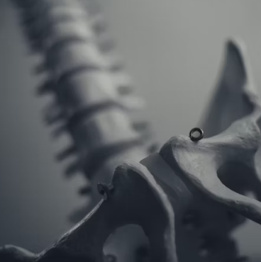 골다공증에 좋은 음식 예방 식단