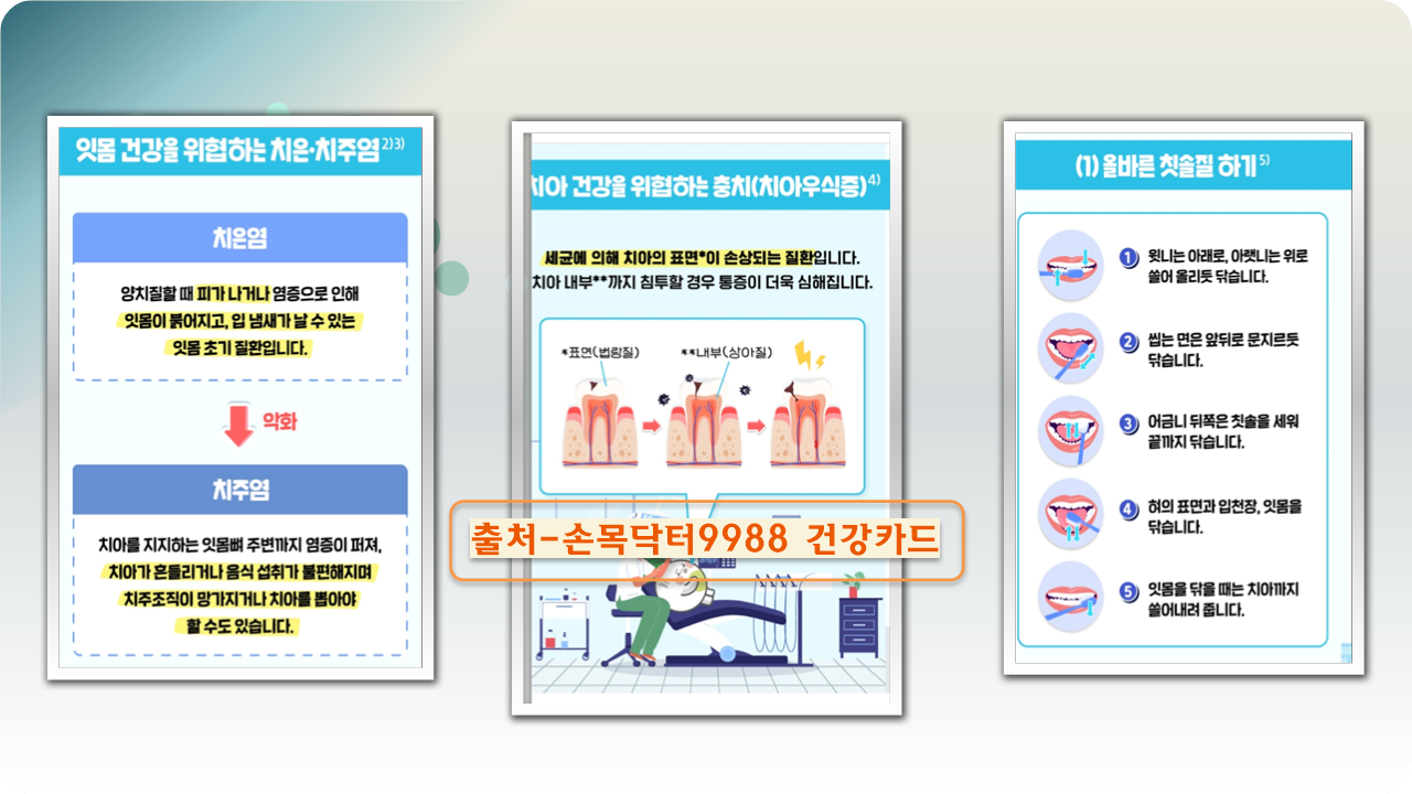 치주염 증상에 대하여 알아보기