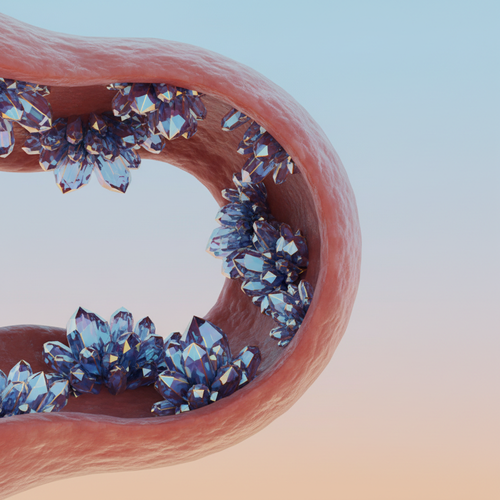 나쁜 콜레스테롤(LDL)이 우리 몸에 미치는 영향