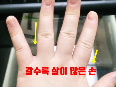 손가락 살이 많은 손
