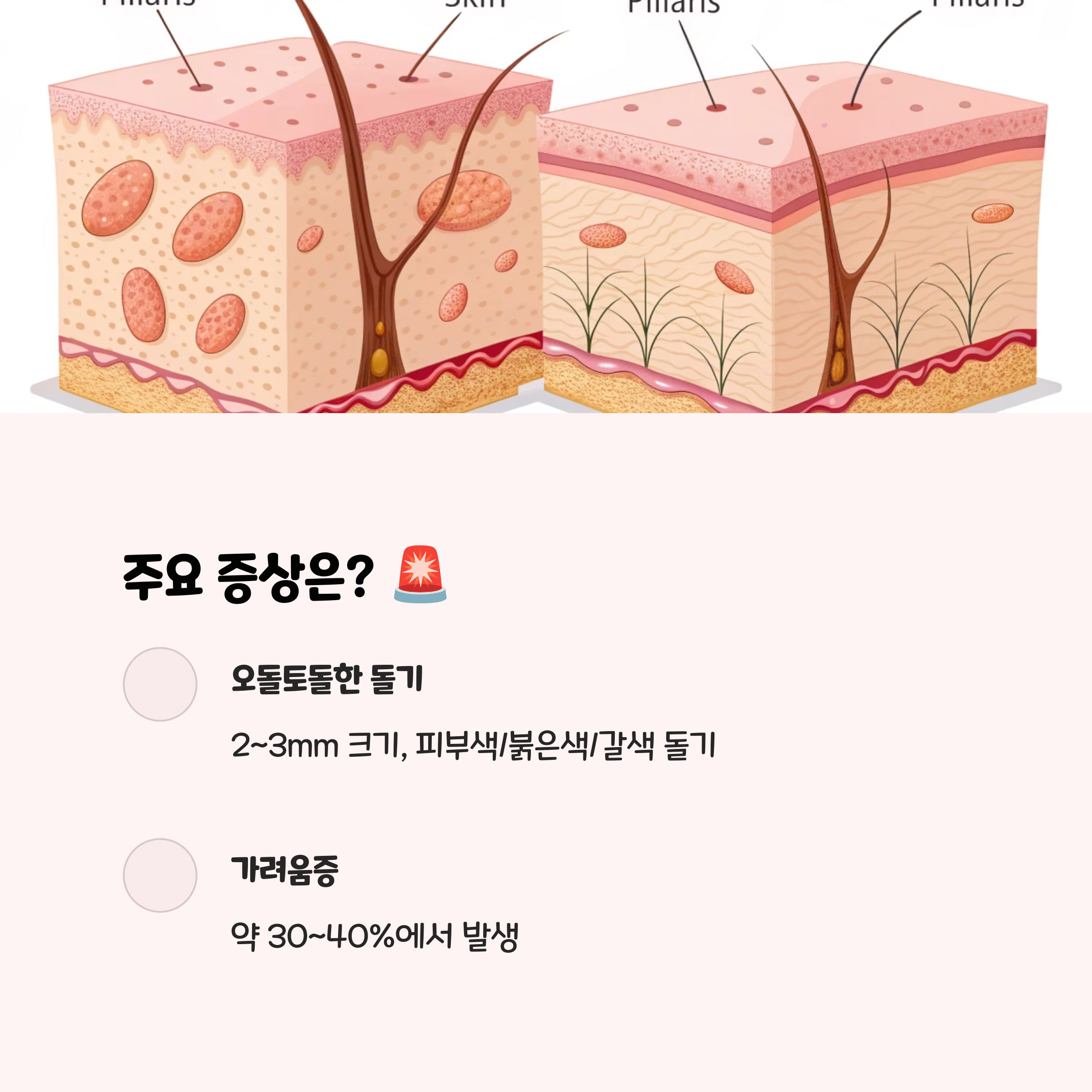 어떤 증상이 나타날까요? 🚨