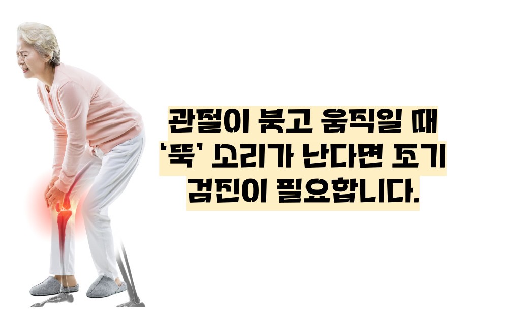 류마티스 관절염 초기증상