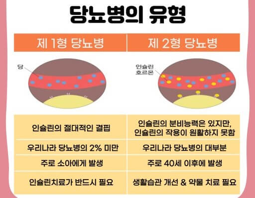 당뇨병 종류