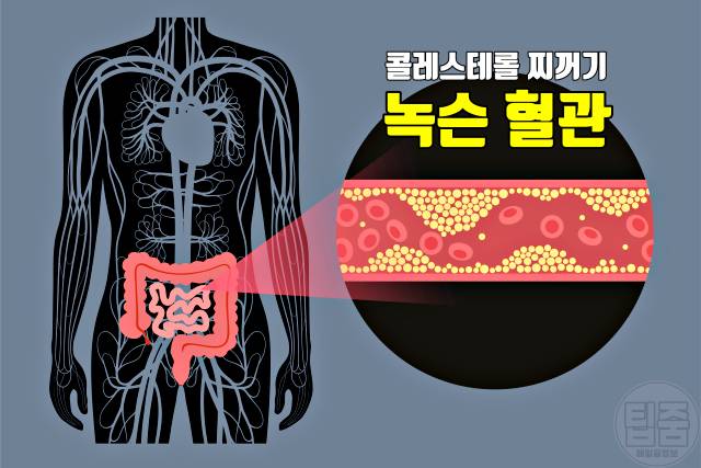 탄수화물 중독 증상 탄수화물중독자가진단 치료법 극복