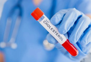 콜레스테롤수치 검사