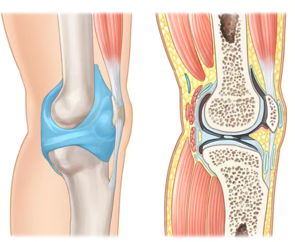 무릎-관절염에-좋은-운동-주의사항