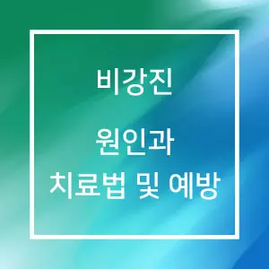 비강진 원인과 치료법 및 예방