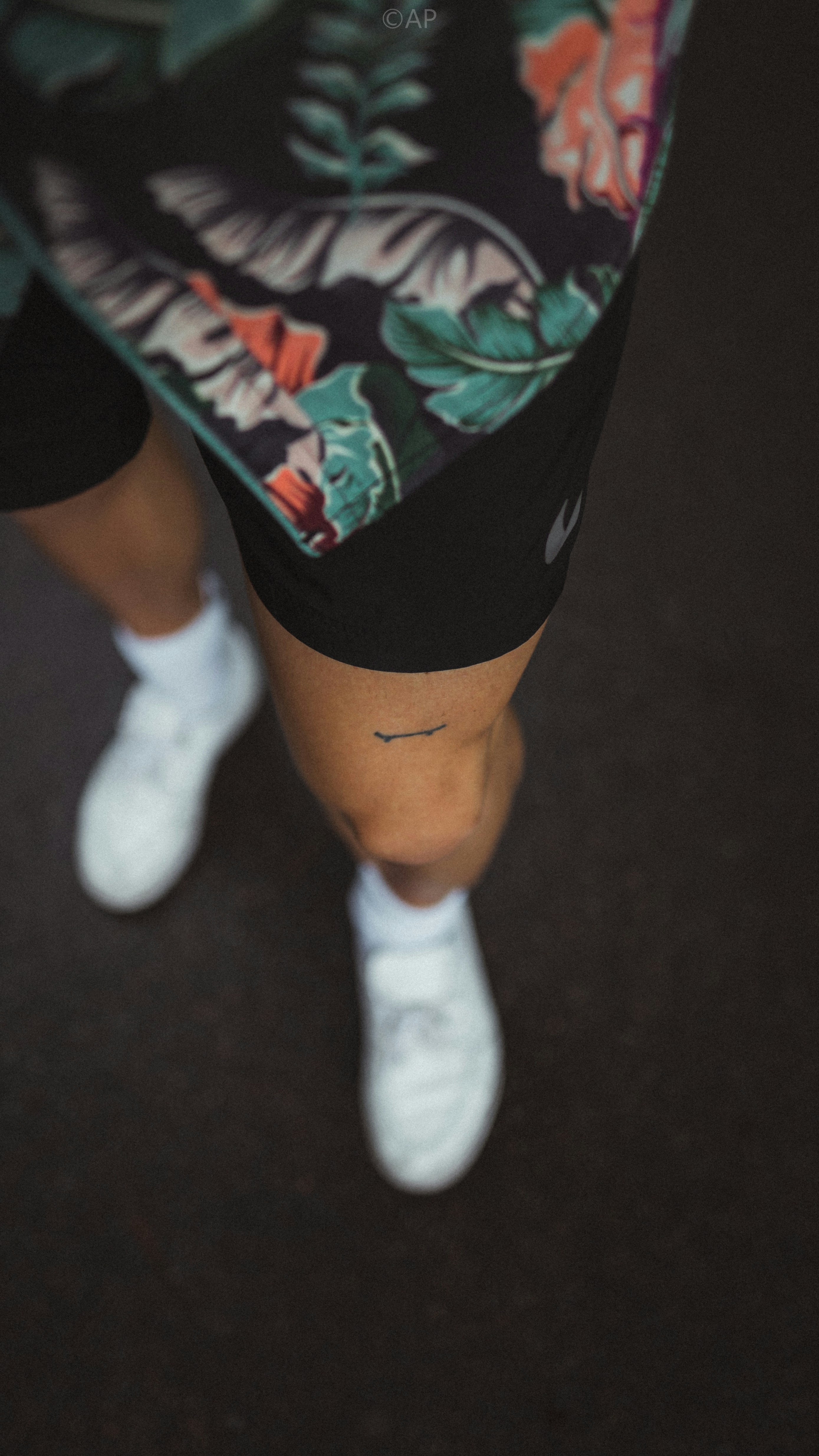 허벅지앞쪽통증원인