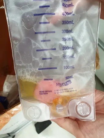 폐에 물이 차는 원인 증상 물참 관리 포인트에 대한 건강정보_24