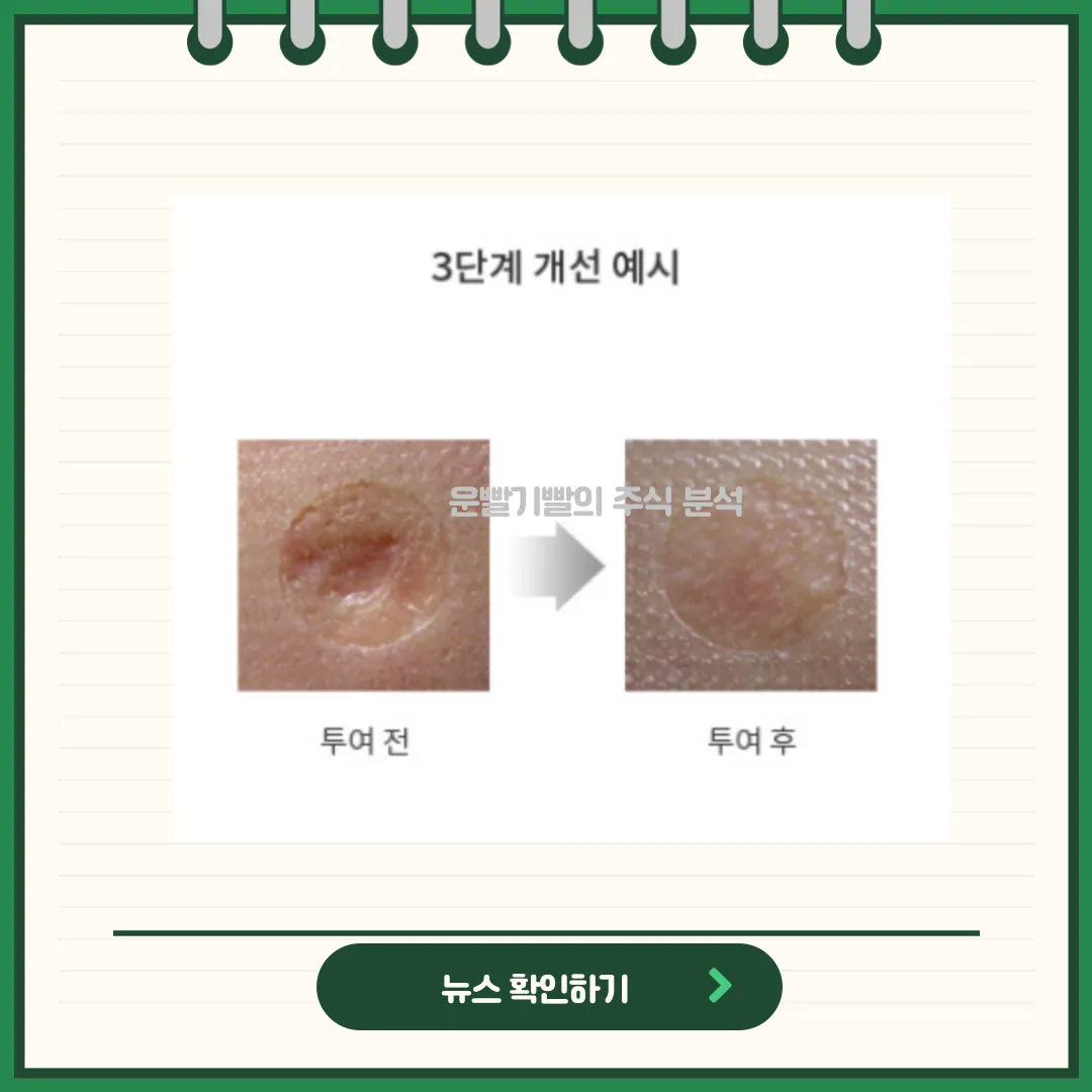 에스바이오메딕스 뉴스