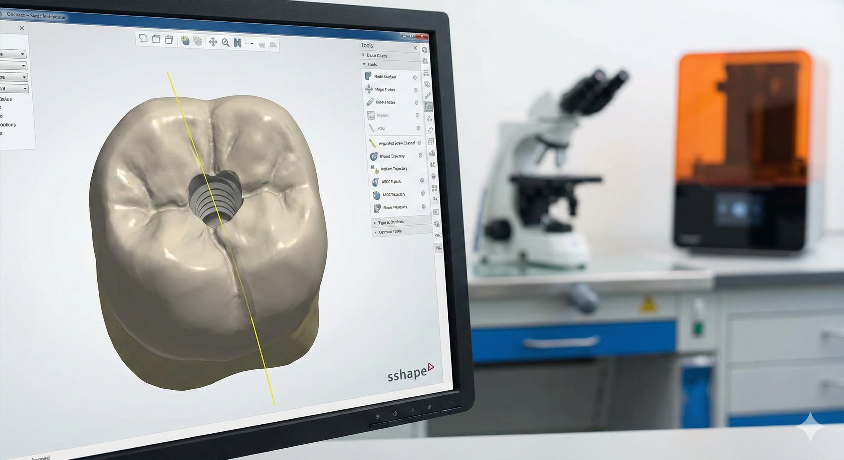 임플란트 치아 위에 왜 구멍이 있나요? 기공사가 말하는 '스크류 홀'의 비밀