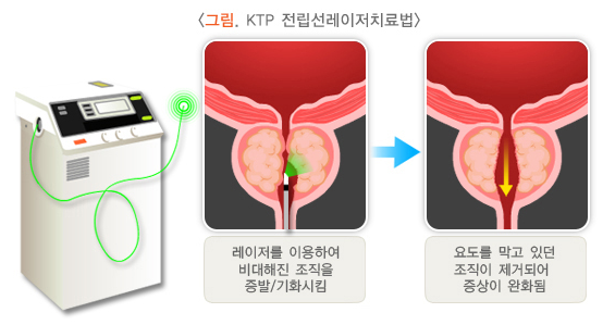 전립선 비대증 수술 비용