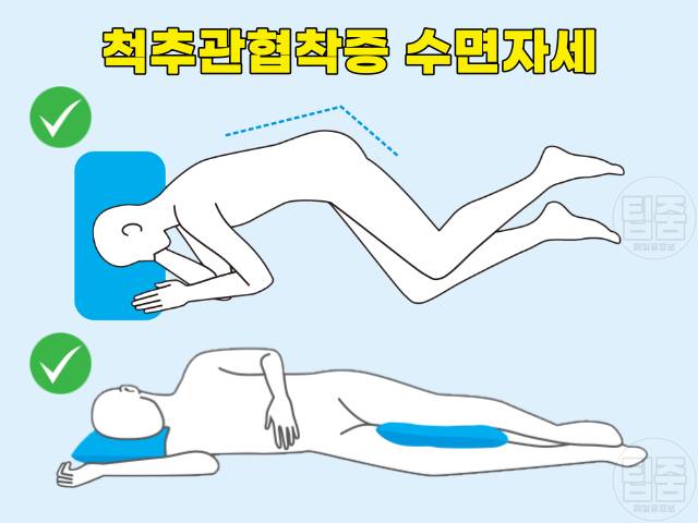 허리에 좋은 수면자세 나쁜자세 척추관협착증
