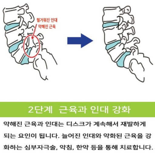 2단계 근육과 인대 강화