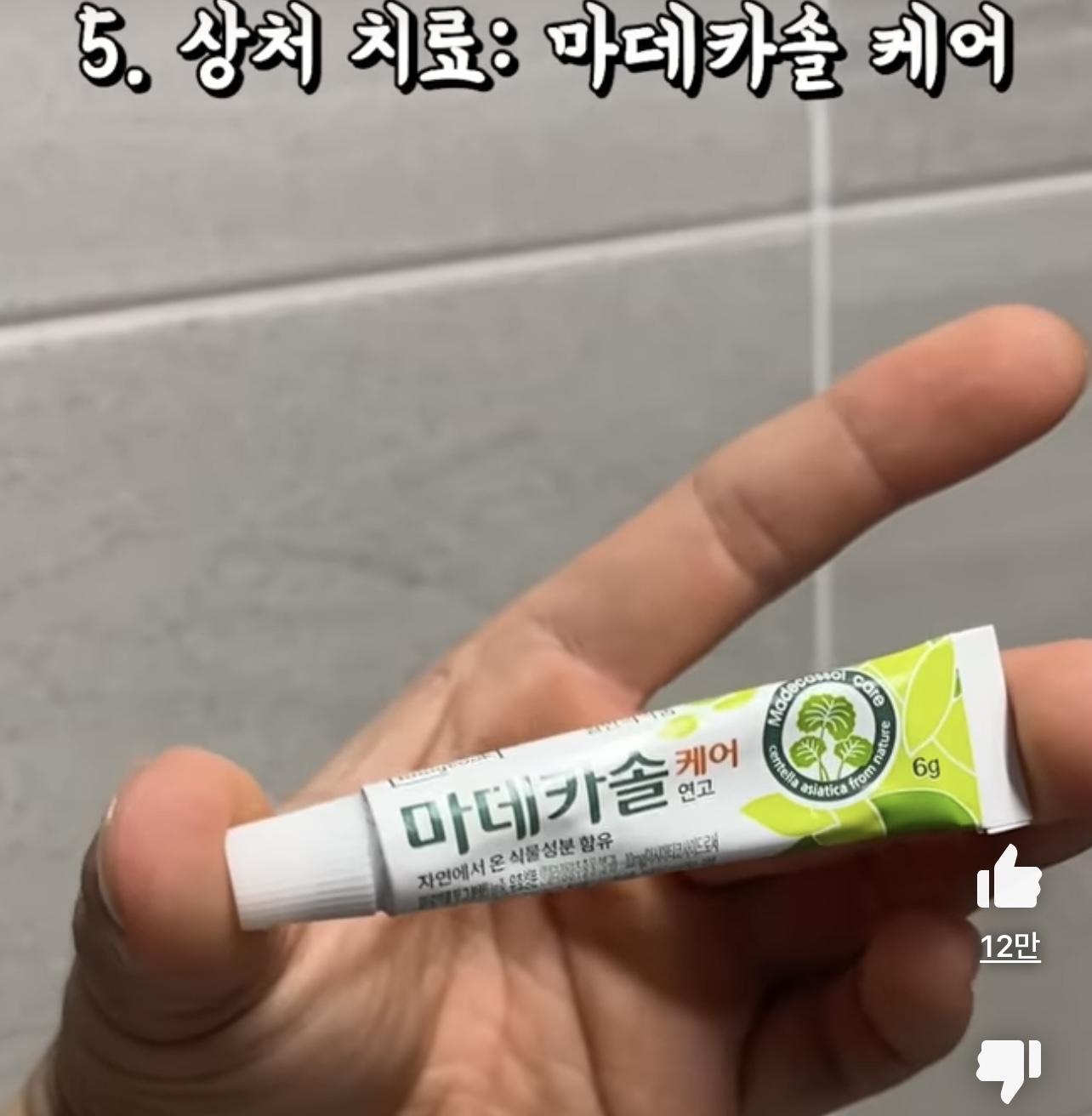 흉터 없이 여드름 짜는 방법