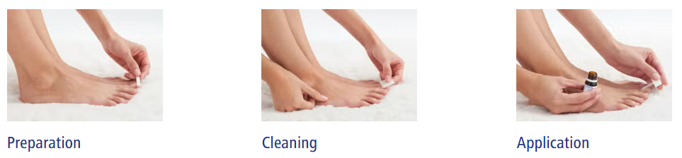 발톱 무좀으로 약을 처방 받았는데, 어떻게 써야하는지 모르겠다 feat. 로세릴 네일라카 바르는법