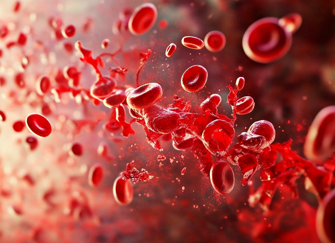 혈전용해제 사진