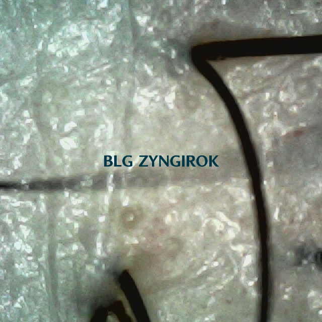 탈모 극복 프로젝트 - 뒷머리 두피 모습이다.