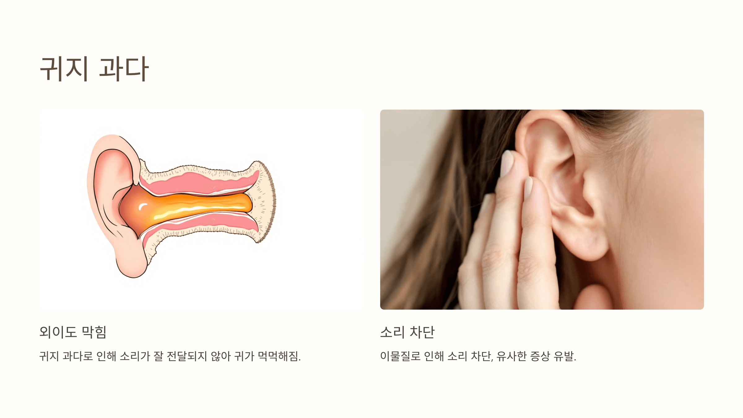 귀 사진입니다.