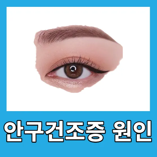 안구건조증 원인
