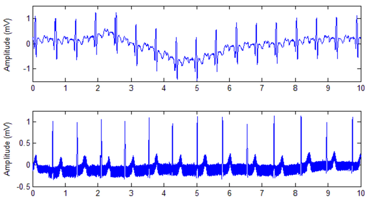 규칙적인 소음 파형