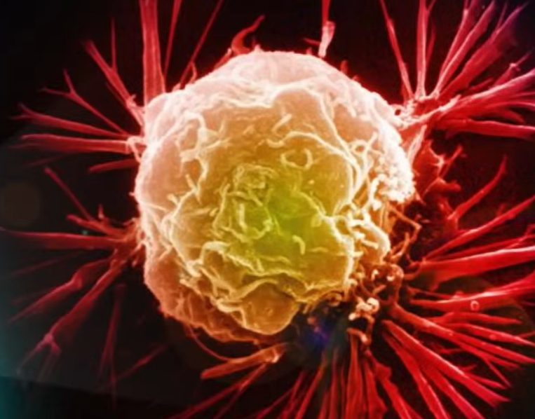 hpv 바이러스 증상