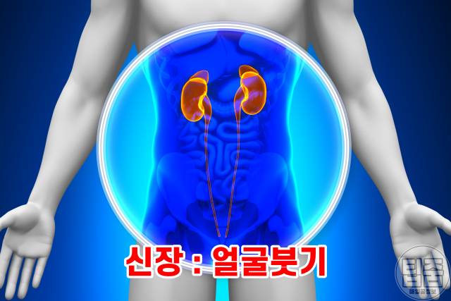 얼굴붓기 빨리 빼는법,얼굴붓기빼는법,얼굴붓는병