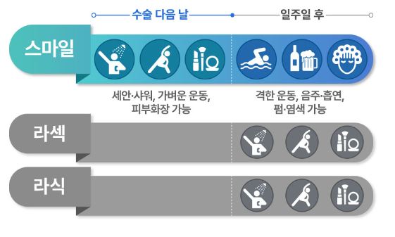 스마일라식-장점