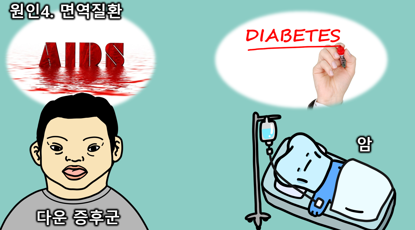 입술옆 찢어짐, 구각염 연고와 구순구각염 치료법, 구강내과의사가 알려드림