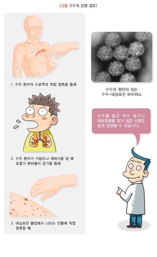 대상포진 증상