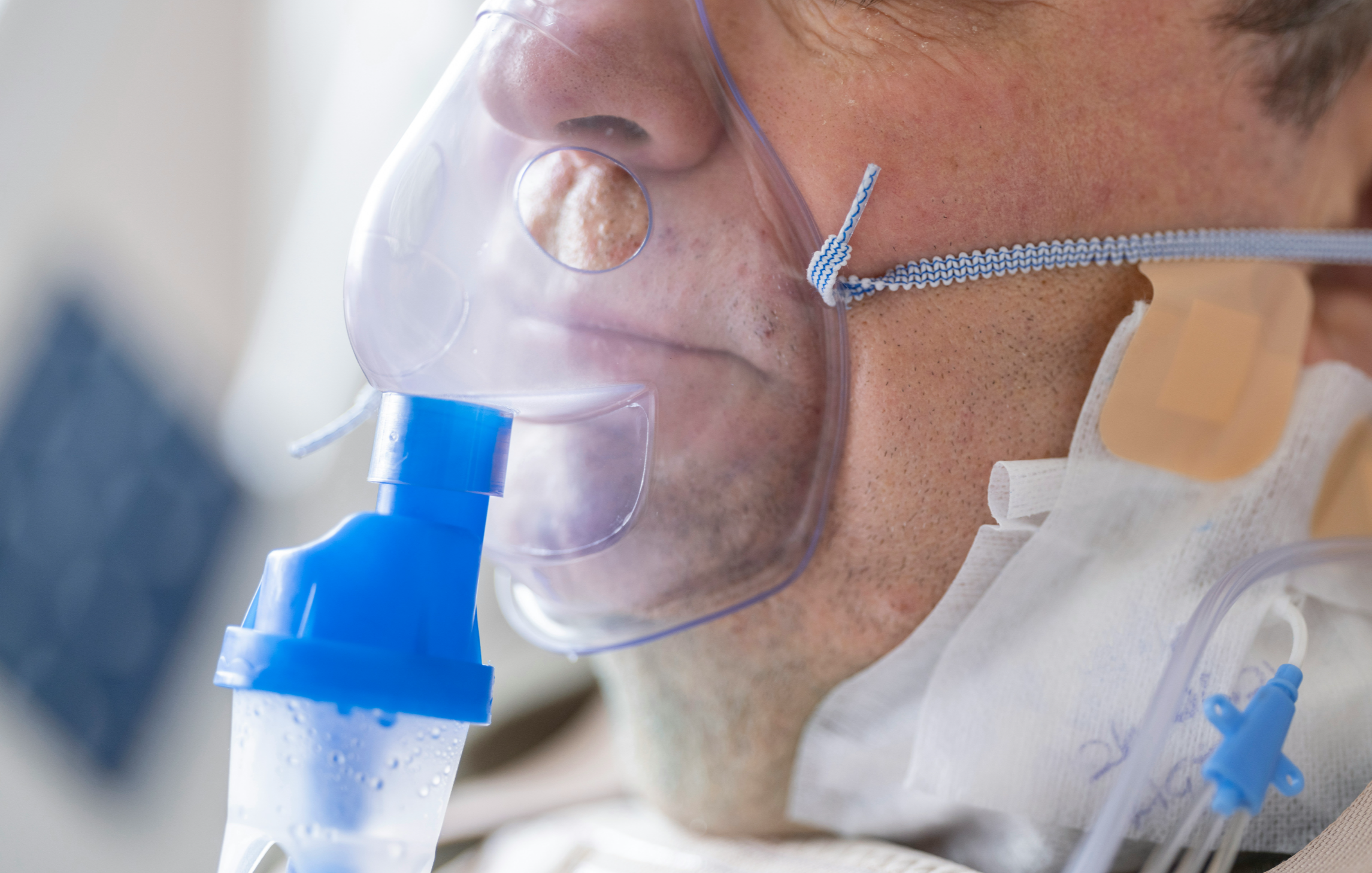 산소치료를 받고 있는 모습